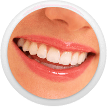 Smile-image
