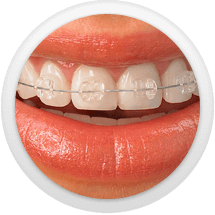 Smile-image